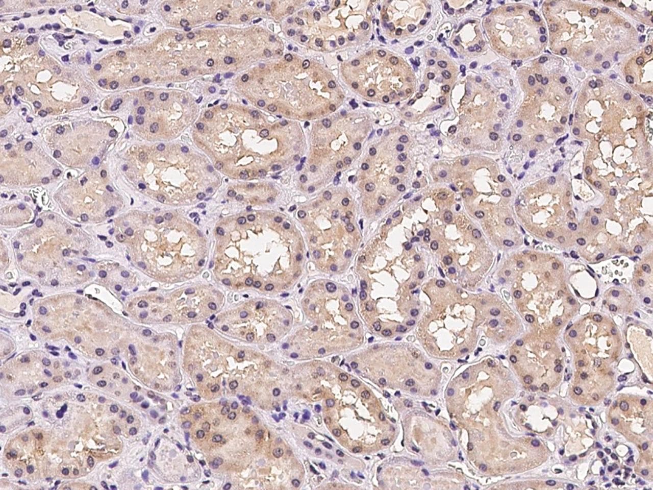 Polyclonal Rabbit anti-Human FLRT1 Antibody (IHC, IF)