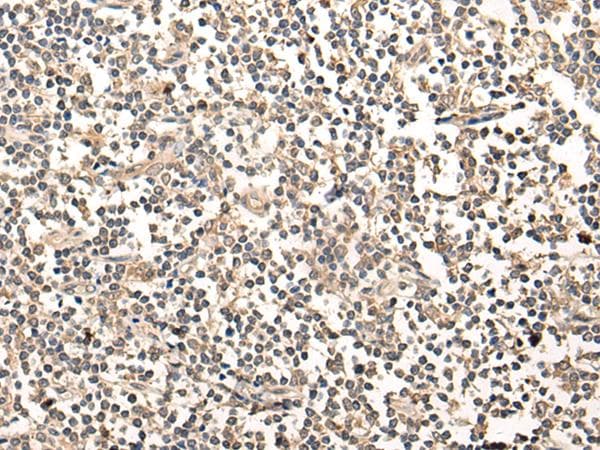 MAGEA1 / MAGE 1 Antibody