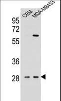 IL12B / IL12 p40 Antibody (aa264-290)