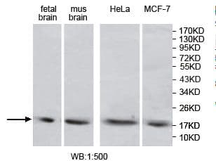 Polyclonal Rabbit anti-Human MAP1LC3A / LC3A Antibody (aa2-121, IHC, WB)