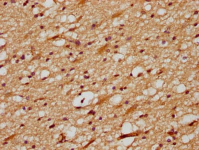 Delta3 / DLL3 Antibody (aa27-492)
