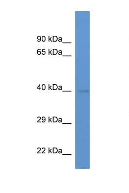 EXOG / ENDOGL1 Antibody (aa72-121)