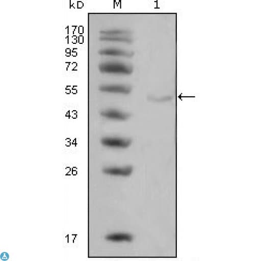 LPL / Lipoprotein Lipase Antibody