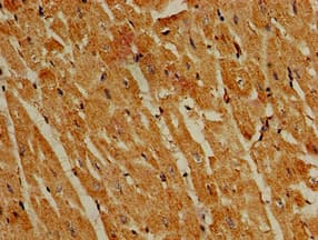 Polyclonal Rabbit anti-Human PIK3R4 Antibody (IHC, IF)