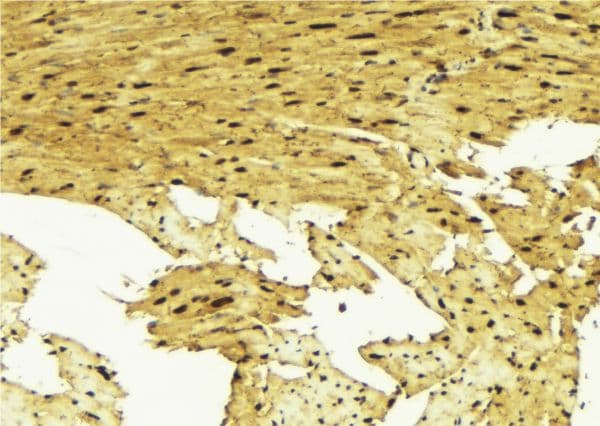 SMAD1 Antibody (phospho-Ser187)