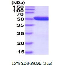 Human PGD Protein (Recombinant His)