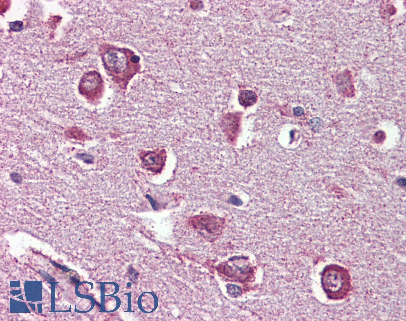 IHC-plus™ Dipeptidylpeptidase 10 / DPP10 Antibody (Internal)