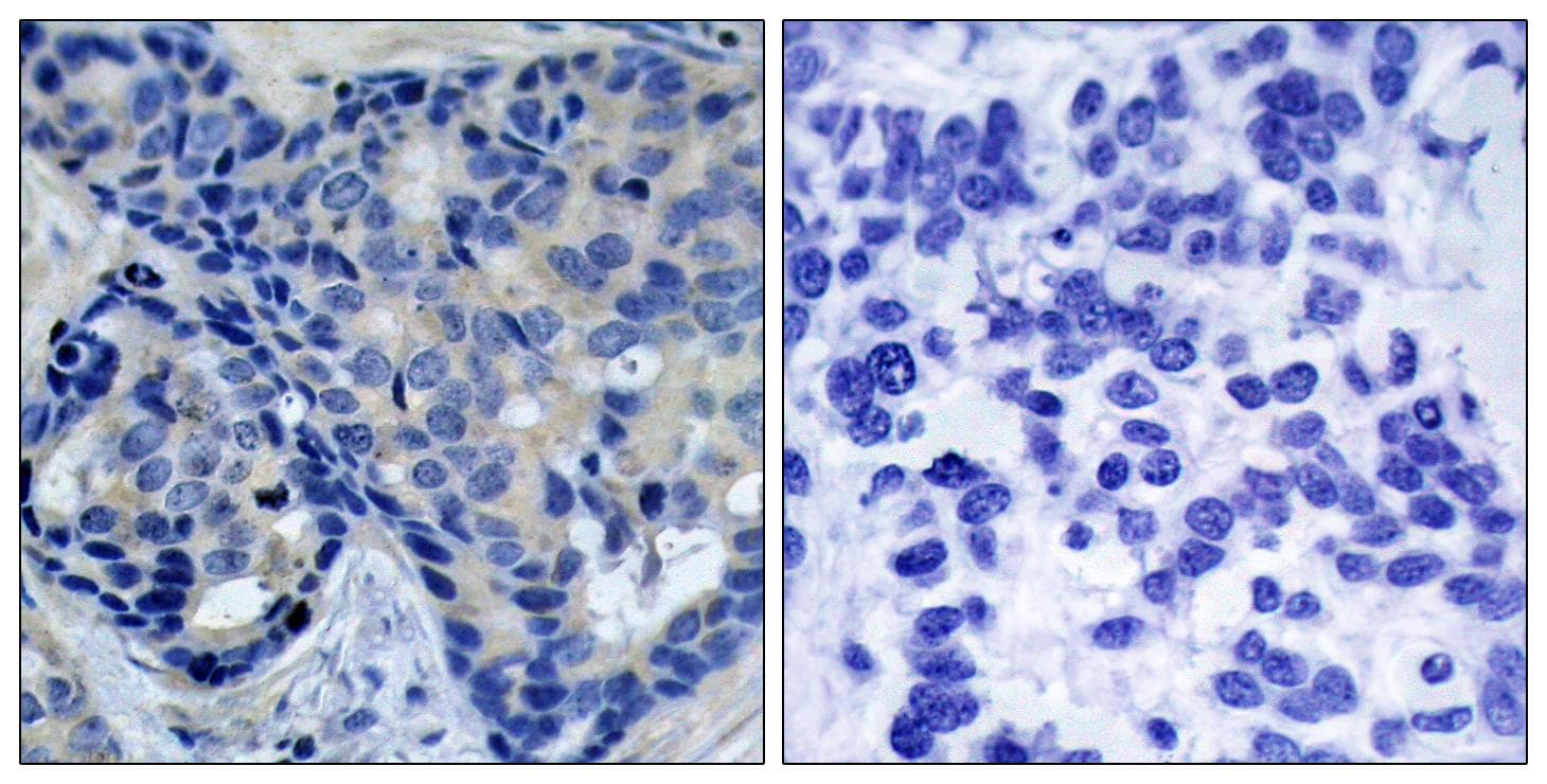 PTK2B / PYK2 Antibody (phospho-Tyr402)