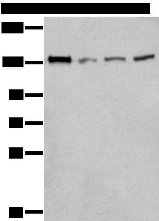 Polyclonal Rabbit anti-Human MORC2 Antibody (IHC, WB)