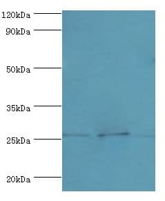 CLDN14 / Claudin 14 Antibody (aa140-239)