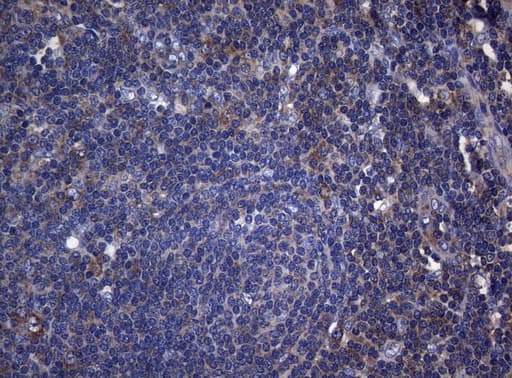 RPL10 / Ribosomal Protein L10 Antibody (clone OTI9A8)