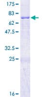 Human MMAA Protein (Recombinant GST)