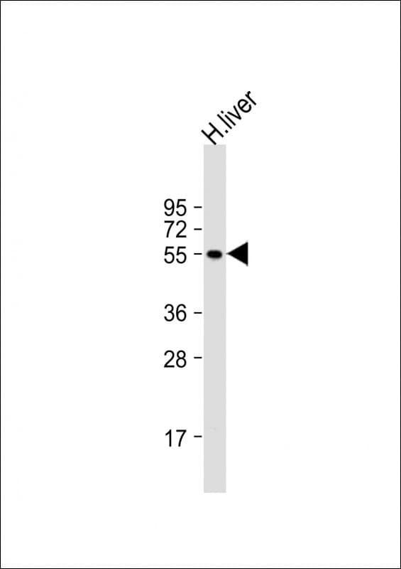 CYP2E1 Antibody (aa66-100)