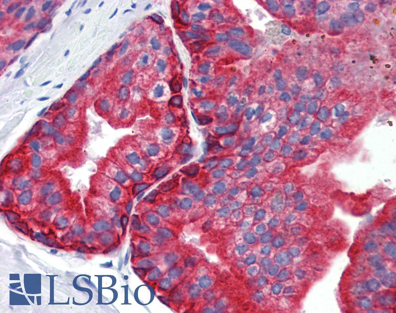 IHC-plus™ KRT5 / CK5 / Cytokeratin 5 Antibody (clone 10)