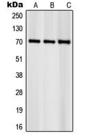 RPS6KB1 / P70S6K / S6K Antibody (phospho-Ser418)