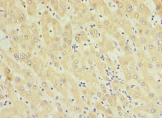 Polyclonal Rabbit anti-Human TMEM91 Antibody