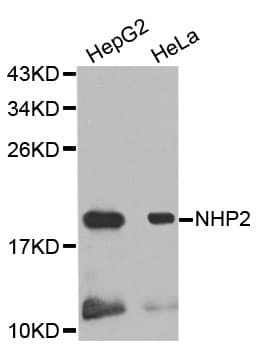 Polyclonal Rabbit anti-Human NOLA2 Antibody (WB)