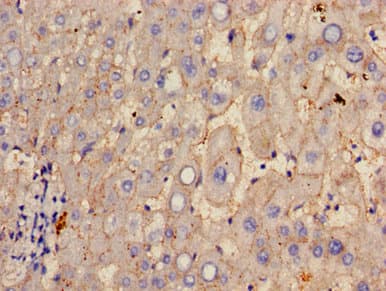 GGT1 / GGT Antibody