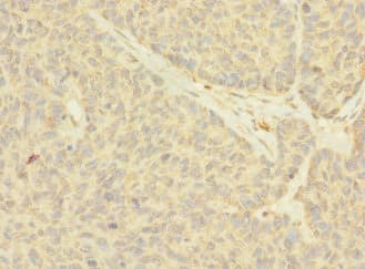 Polyclonal Rabbit anti-Human NANOS2 / NOS2 Antibody