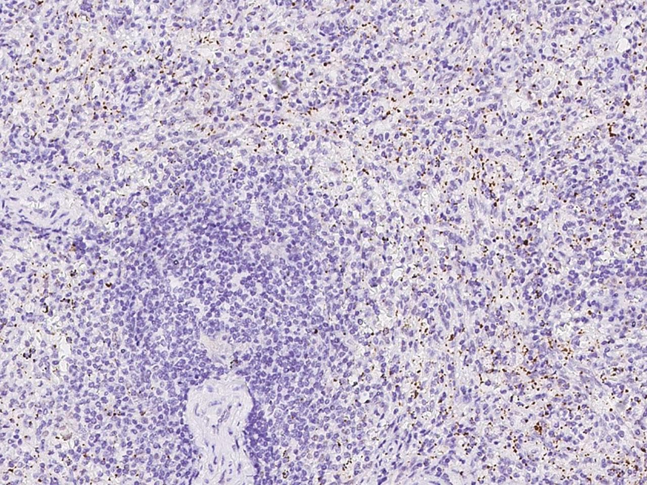 Polyclonal Rabbit anti-Human TREML1 / TLT1 Antibody (Preservative Free, IHC, IF)