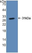 ASGR1 / ASGPR Antibody (aa77-289, Biotin)