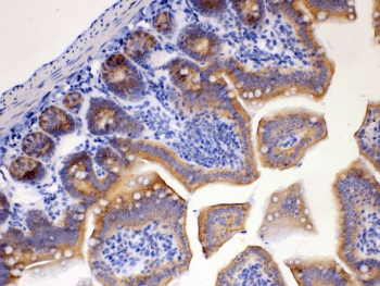 Polyclonal Rabbit anti-Human PA2G4 / EBP1 Antibody (IHC, WB)