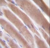VEGFC Antibody (aa20-49)