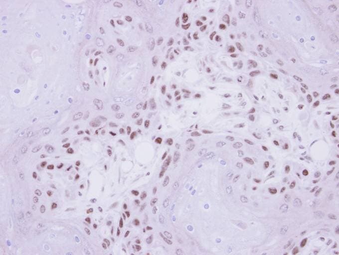 Polyclonal Rabbit anti-Human IP6K1 Antibody (aa50-309, IHC, WB)