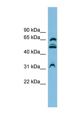 Polyclonal Rabbit anti-Human WDR1 Antibody (aa107-156, WB)