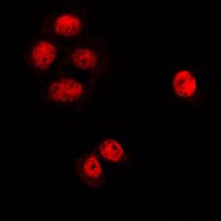 Polyclonal Rabbit anti-Human RACGAP1 / MGCRACGAP Antibody (N-Terminus, IHC, IF, WB)