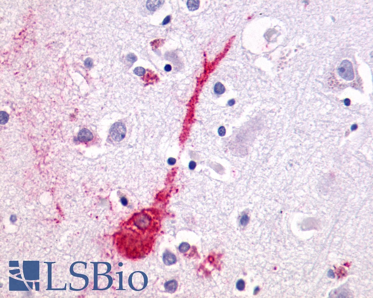 PathPlus™ LPAR4 / GPR23 Antibody (N-Terminus)