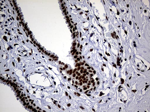 Monoclonal Mouse anti-Human TP53BP1 / 53BP1 Antibody (clone OTI6D9, aa1-300, IHC, WB)