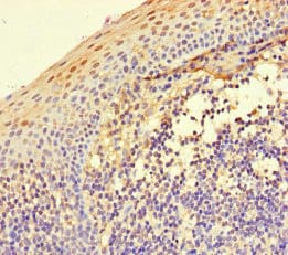 ITGA4 / VLA-4 / CD49d Antibody