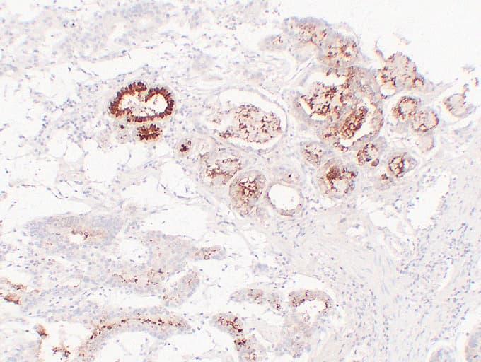 MUC6 / MUC-6 Antibody (clone ABT-MUC6)