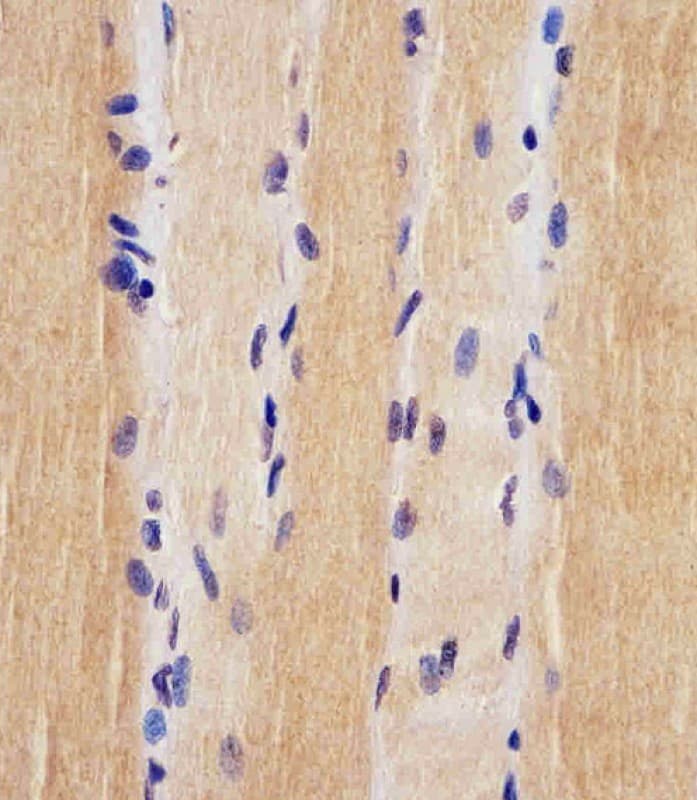USP47 Antibody (aa588-620)