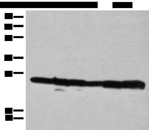 RPL14 / Ribosomal Protein L14 Antibody