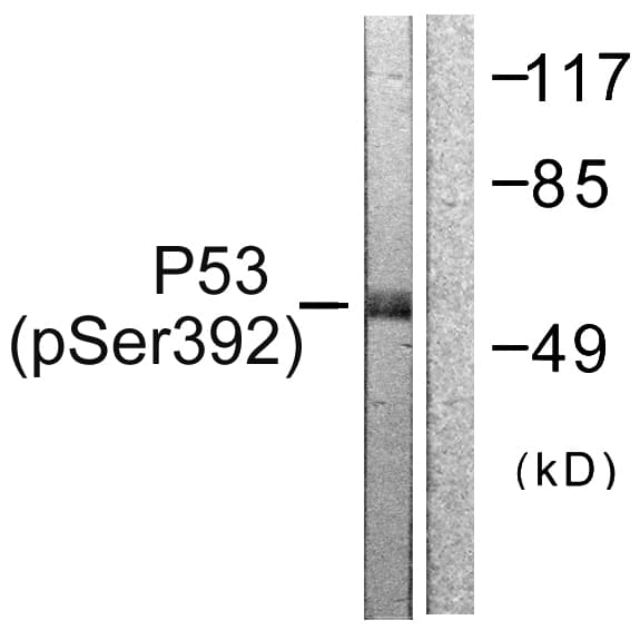 Polyclonal Rabbit anti-Human TP53 / p53 Antibody (phospho-Ser392, IHC, IF, WB)