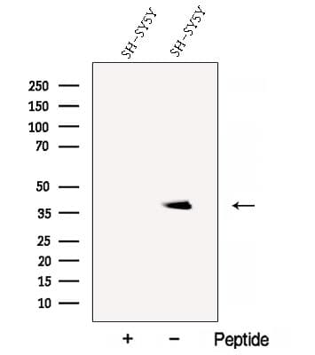 Polyclonal Rabbit anti-Human BHLHE22 / BHLHB5 Antibody (WB)