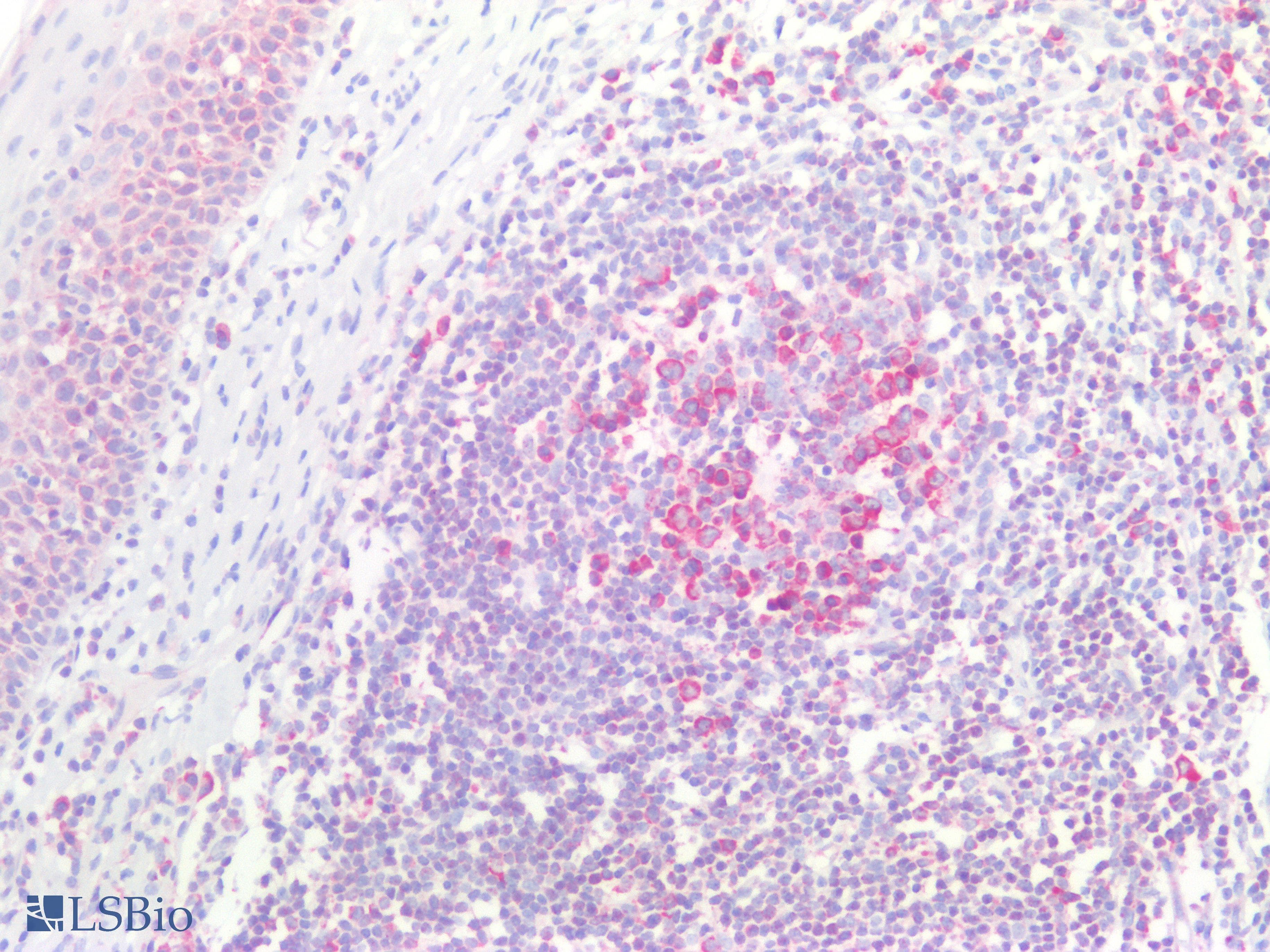 PathPlus™ RPS2 / Ribosomal Protein S2 Antibody