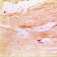 Polyclonal Rabbit anti-Human PRKCQ / PKC-Theta Antibody (C-Terminus, IHC, WB)