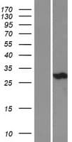 CA3 / Carbonic Anhydrase III Protein (Over-Expression Lysate Myc-DDK (Flag))