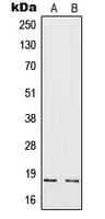 IL4 Antibody (Internal)