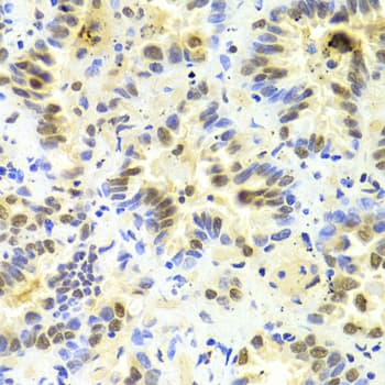 SRSF1 / SF2 Antibody
