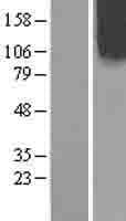 OCRL Protein (Over-Expression Lysate Myc-DDK (Flag))