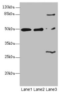 Polyclonal Rabbit anti-Human ZBTB25 Antibody (IHC, WB)