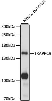 Polyclonal Rabbit anti-Human TRAPPC9 Antibody (WB)