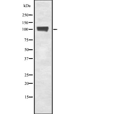 Polyclonal Rabbit anti-Human GTF3C3 Antibody (IF, WB)