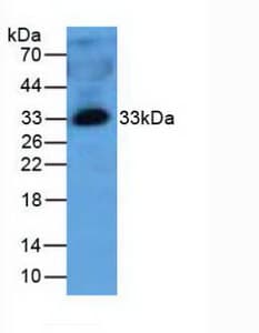 MBL2 / Mannose Binding Protein Antibody (aa130-248)