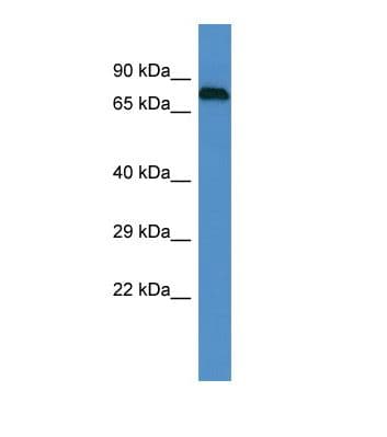 Epsin 1 / EPN1 Antibody (aa574-623)