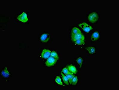 Polyclonal Rabbit anti-Human BTBD6 Antibody (IHC, WB)